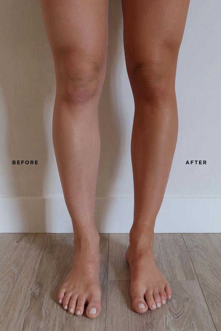 Before and after — Australian Glow on legs