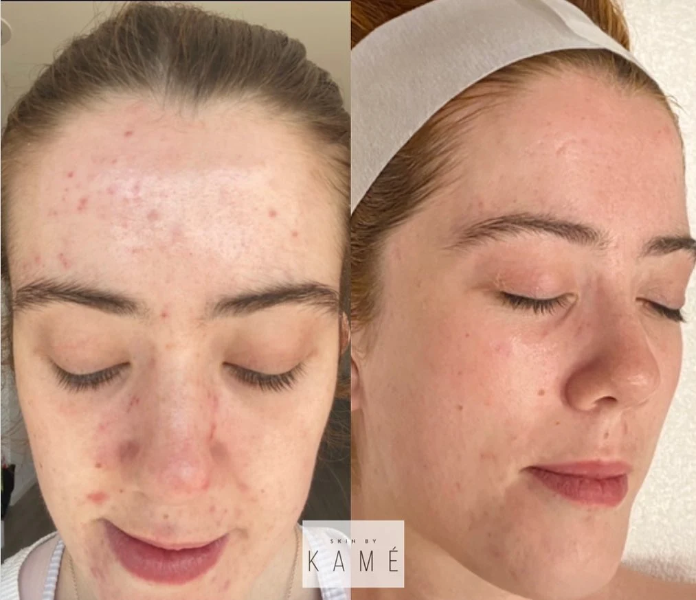 Skin by Kamé treatment room editorial
